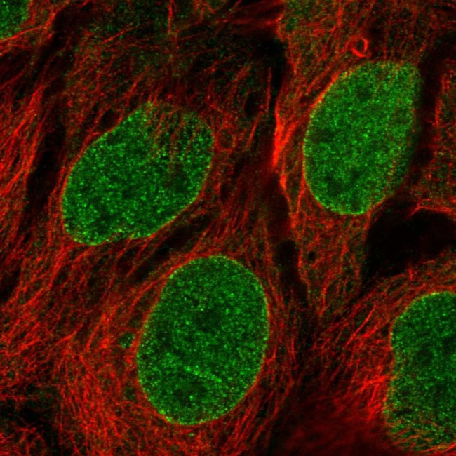 CPNE1 Antibody in Immunocytochemistry (ICC/IF)