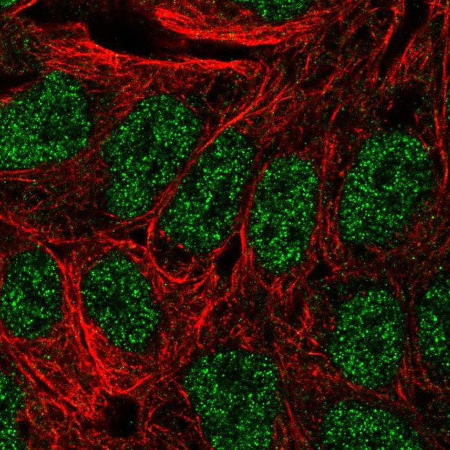 Annexin A8 Antibody in Immunocytochemistry (ICC/IF)