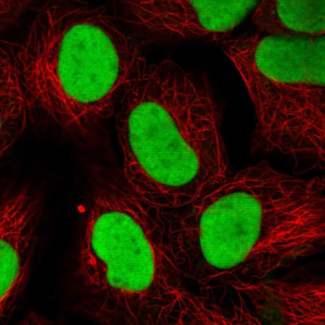 Ku70 Antibody in Immunocytochemistry (ICC/IF)