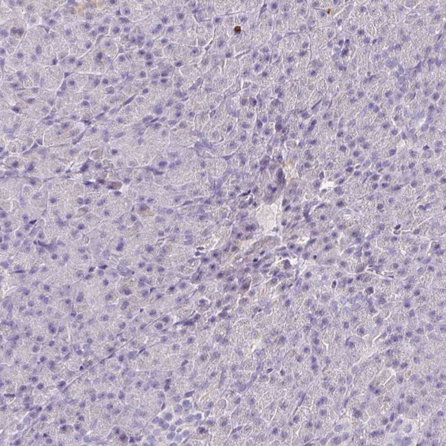 SH2D3C Antibody in Immunohistochemistry (Paraffin) (IHC (P))