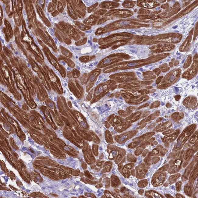 Creatine Kinase MM Antibody in Immunohistochemistry (Paraffin) (IHC (P))