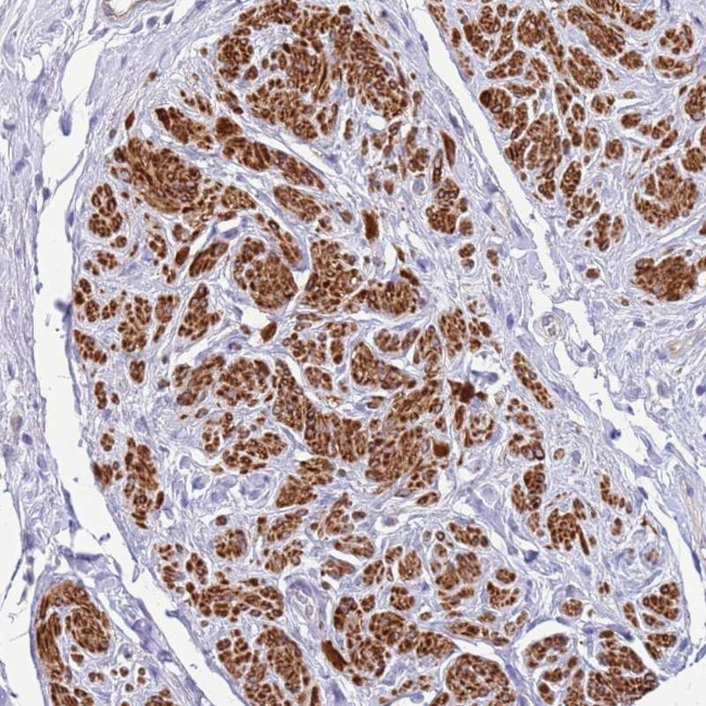 MVD Antibody in Immunohistochemistry (Paraffin) (IHC (P))