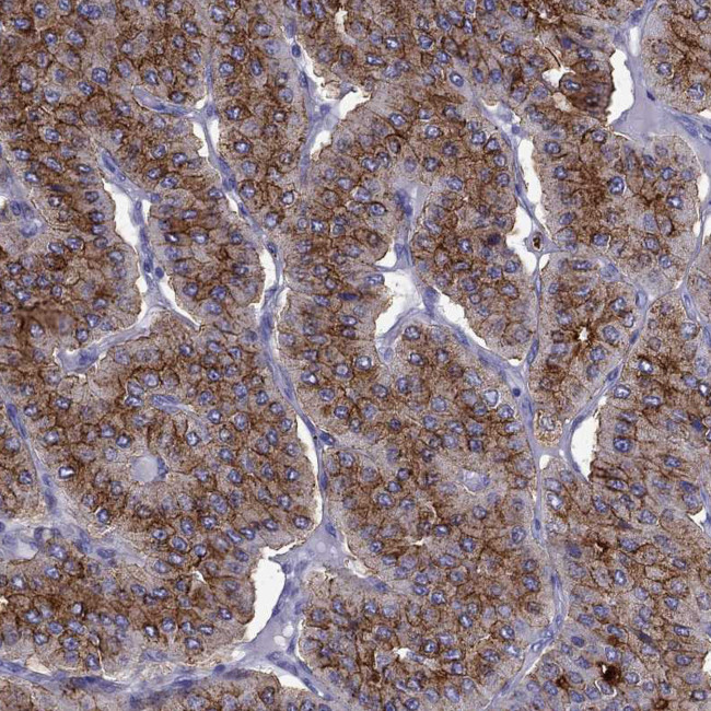 PTH Antibody in Immunohistochemistry (Paraffin) (IHC (P))