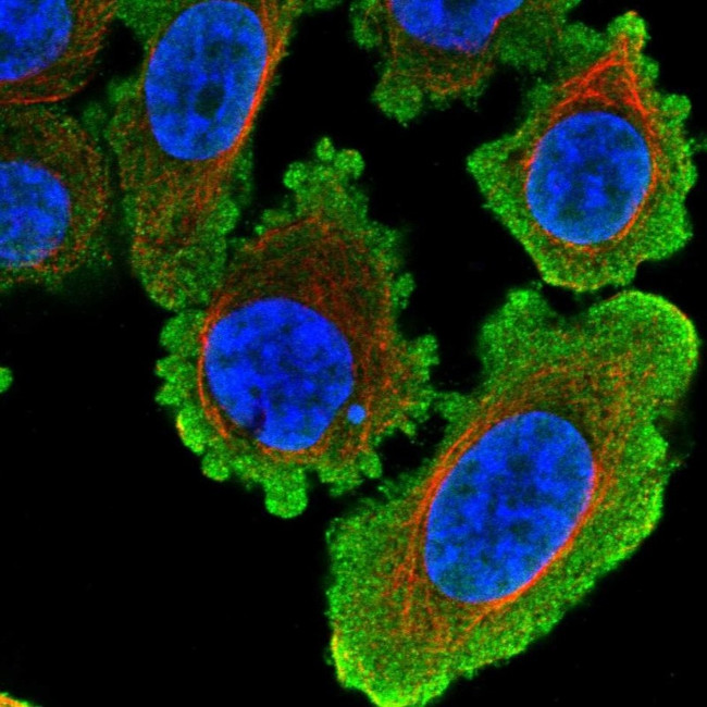 HDAC8 Antibody in Immunocytochemistry (ICC/IF)