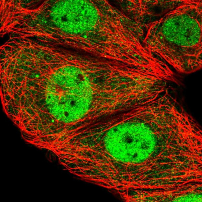 ESRP2 Antibody in Immunocytochemistry (ICC/IF)