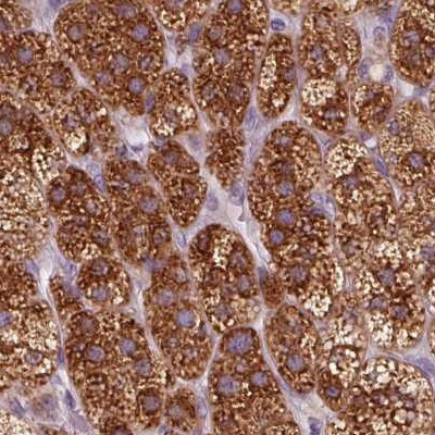 EPHX1 Antibody in Immunohistochemistry (Paraffin) (IHC (P))