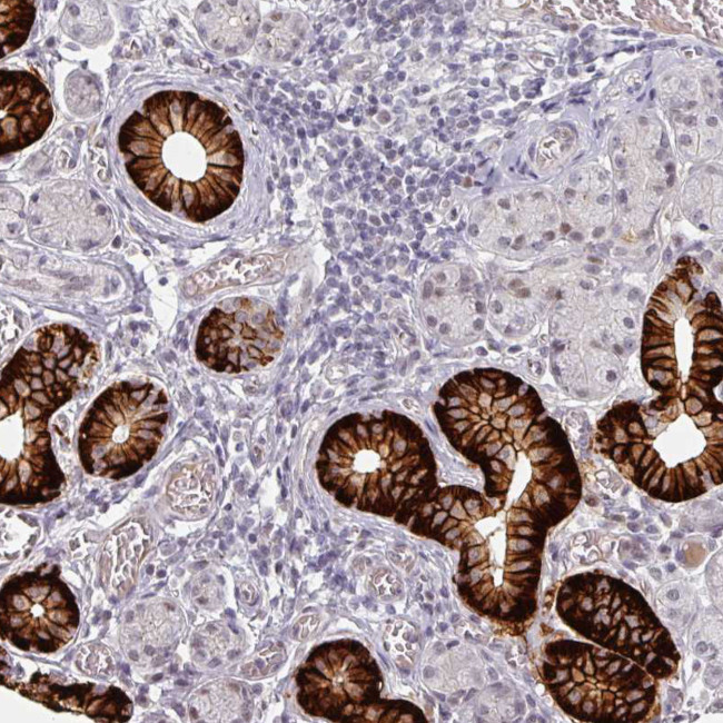 SLC5A5 Antibody in Immunohistochemistry (Paraffin) (IHC (P))