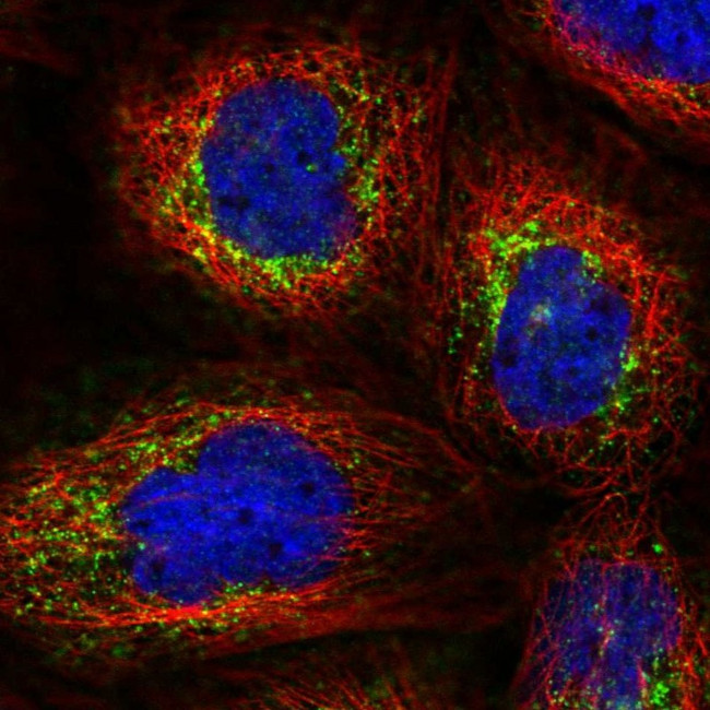 POLB Antibody in Immunocytochemistry (ICC/IF)