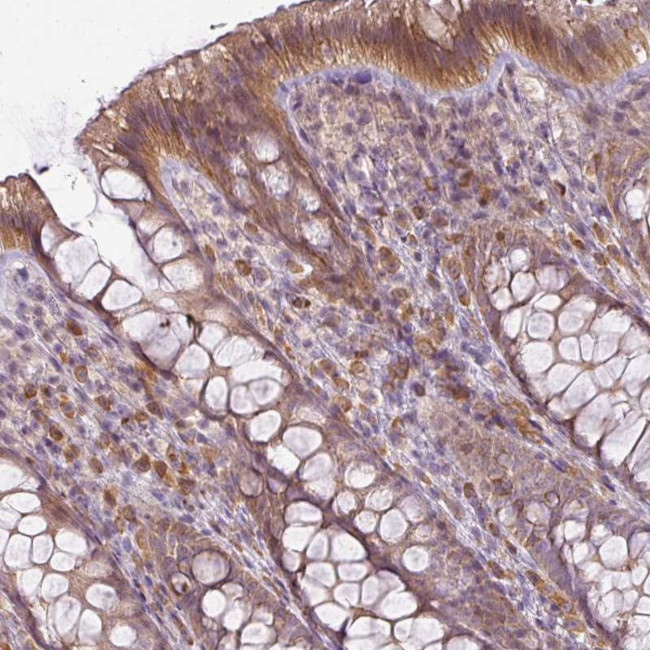 CD205 Antibody in Immunohistochemistry (Paraffin) (IHC (P))