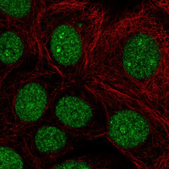 BCL11B Antibody in Immunocytochemistry (ICC/IF)