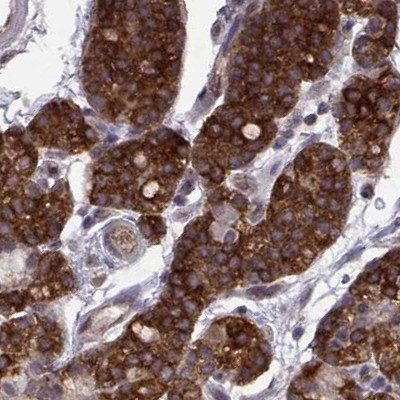 KIF13B Antibody in Immunohistochemistry (Paraffin) (IHC (P))