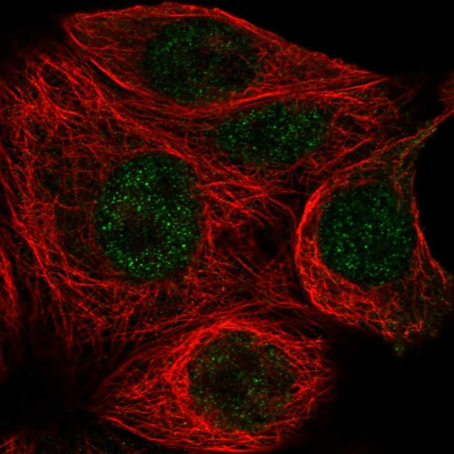 TBP Antibody in Immunocytochemistry (ICC/IF)