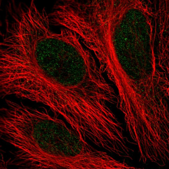 PFKFB2 Antibody in Immunocytochemistry (ICC/IF)