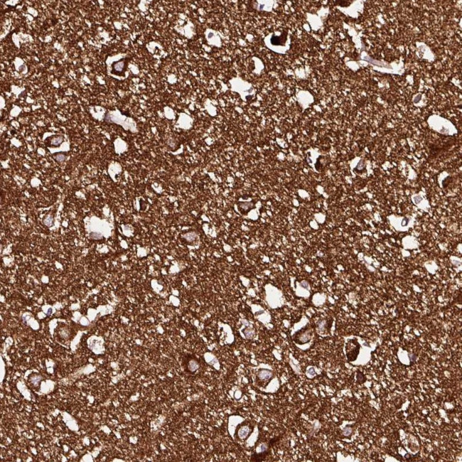 SNAP alpha Antibody in Immunohistochemistry (Paraffin) (IHC (P))