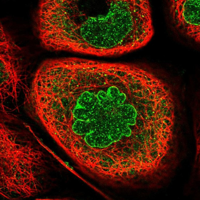 KPNB1 Antibody in Immunocytochemistry (ICC/IF)