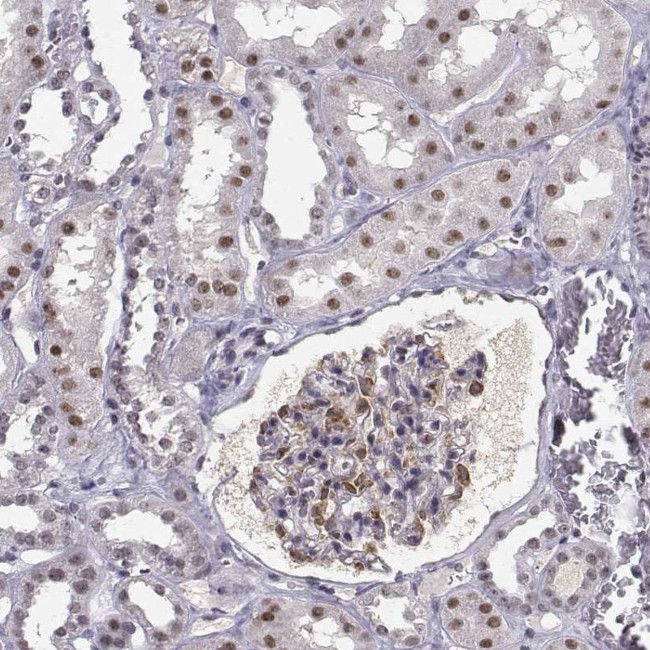 RPP38 Antibody in Immunohistochemistry (Paraffin) (IHC (P))