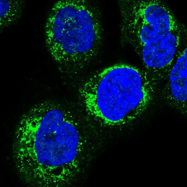 HSDL2 Antibody in Immunocytochemistry (ICC/IF)