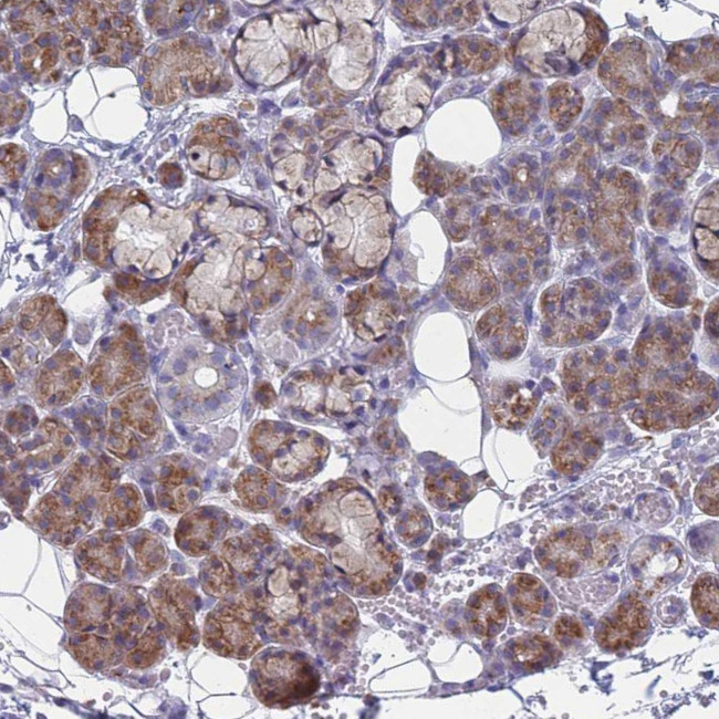 TMP21 Antibody in Immunohistochemistry (Paraffin) (IHC (P))