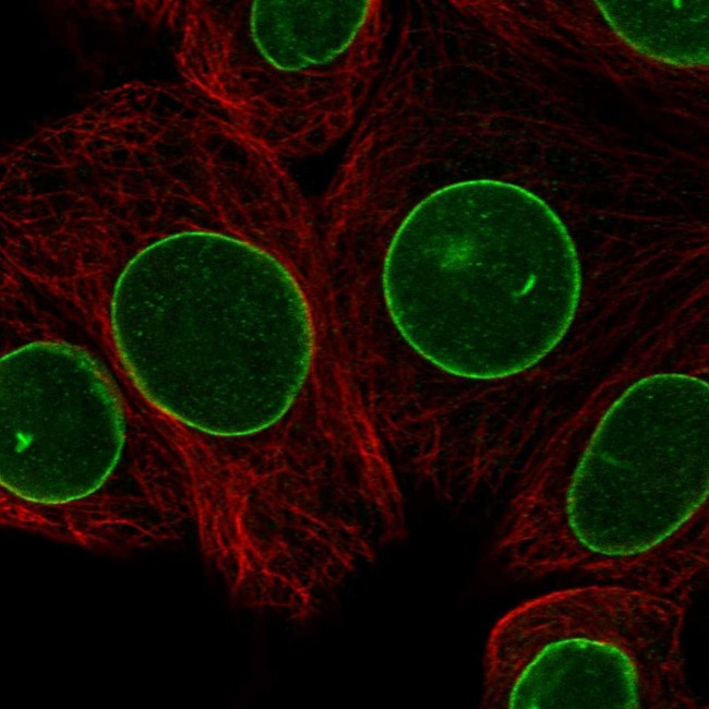 LAP1 Antibody in Immunocytochemistry (ICC/IF)