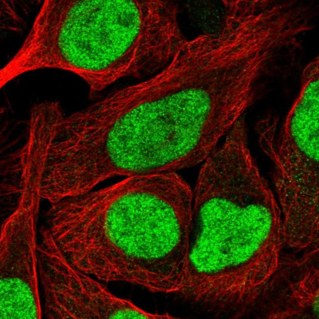 NFYA Antibody in Immunocytochemistry (ICC/IF)