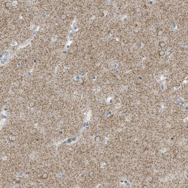 SLC25A23 Antibody in Immunohistochemistry (Paraffin) (IHC (P))