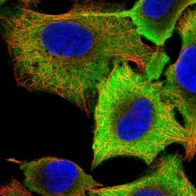 ALDH3A1 Antibody in Immunocytochemistry (ICC/IF)