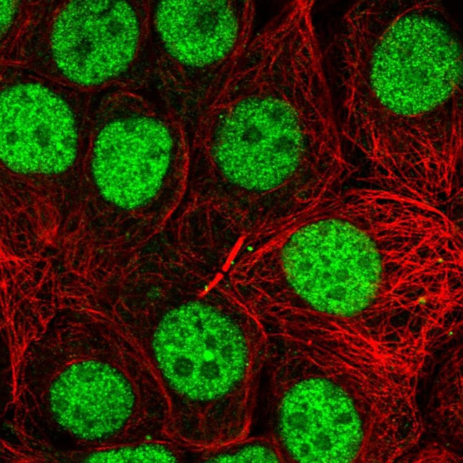 TRBP Antibody in Immunocytochemistry (ICC/IF)