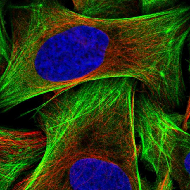 Calponin 3 Antibody in Immunocytochemistry (ICC/IF)