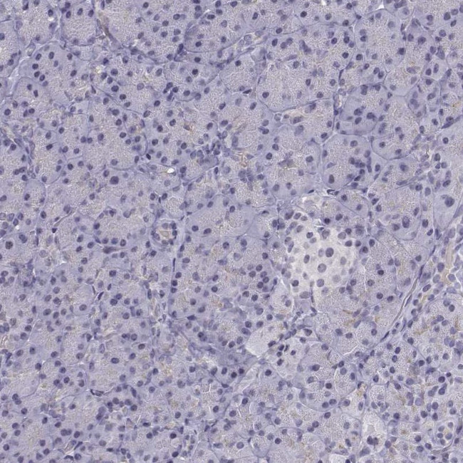 INCENP Antibody in Immunohistochemistry (Paraffin) (IHC (P))