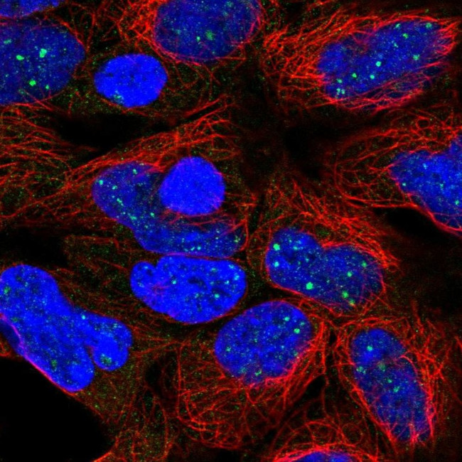 DISP1 Antibody in Immunocytochemistry (ICC/IF)