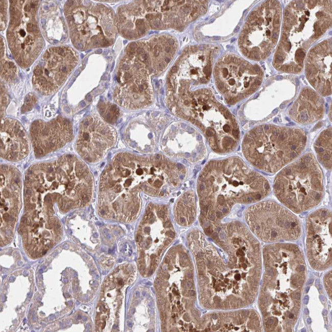 Diazepam Binding Inhibitor Antibody in Immunohistochemistry (Paraffin) (IHC (P))