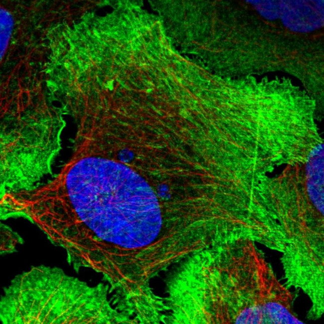 Drebrin Antibody in Immunocytochemistry (ICC/IF)