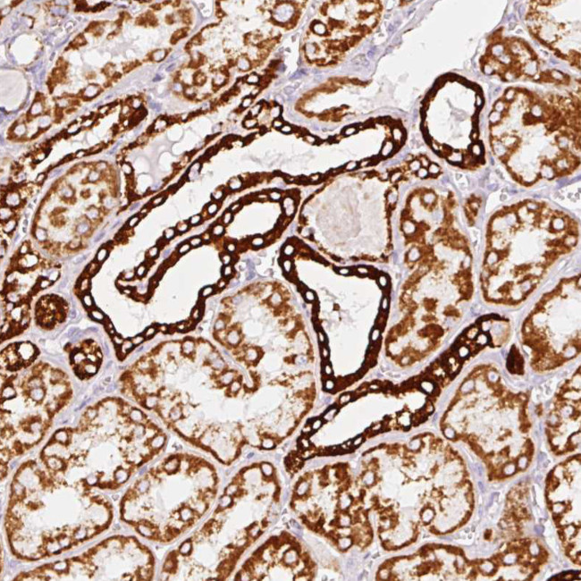 MT-CO2 Antibody in Immunohistochemistry (Paraffin) (IHC (P))