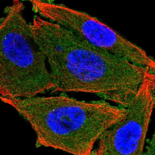 CaMKII alpha Antibody in Immunocytochemistry (ICC/IF)