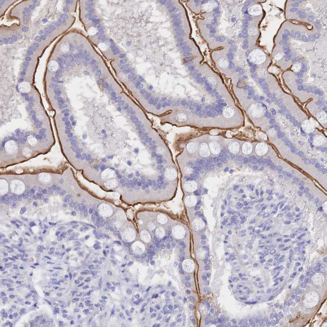 SGLT1 Antibody in Immunohistochemistry (Paraffin) (IHC (P))