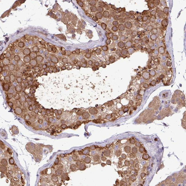 KIR3DX1 Antibody in Immunohistochemistry (Paraffin) (IHC (P))