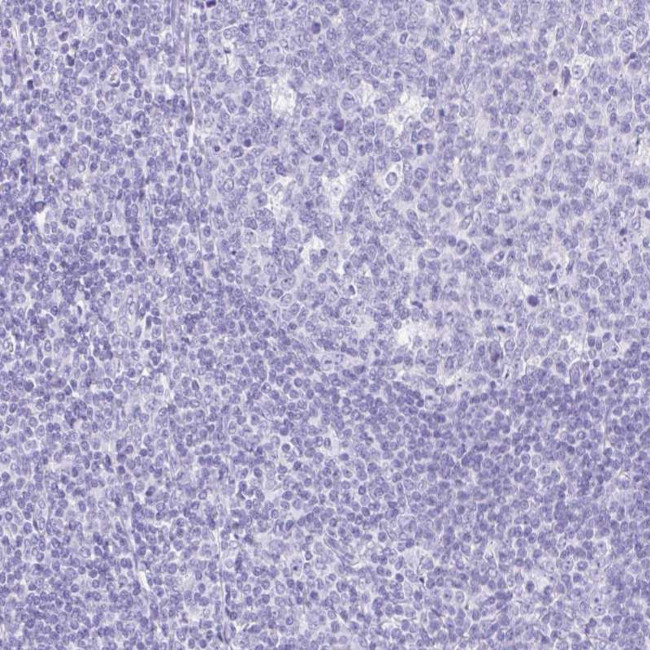 Carboxypeptidase A1 Antibody in Immunohistochemistry (Paraffin) (IHC (P))