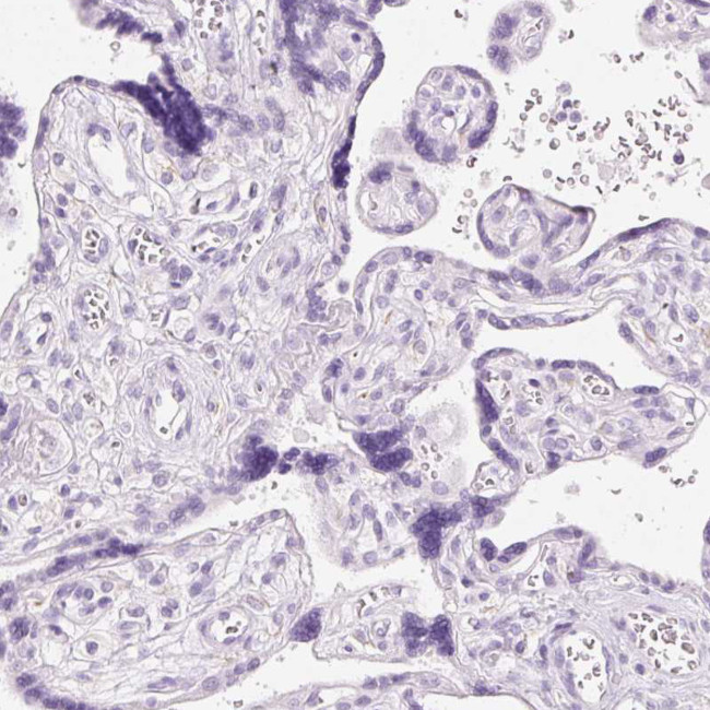 Mast Cell Chymase Antibody in Immunohistochemistry (Paraffin) (IHC (P))