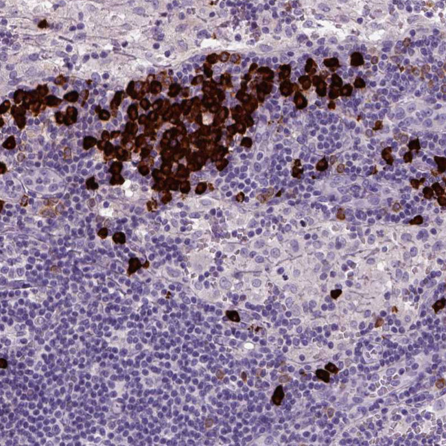 MZB1 Antibody in Immunohistochemistry (Paraffin) (IHC (P))