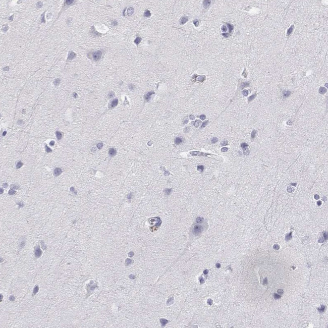 AKR1B1 Antibody in Immunohistochemistry (Paraffin) (IHC (P))