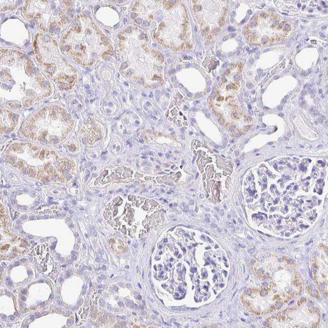 CD21 Antibody in Immunohistochemistry (Paraffin) (IHC (P))