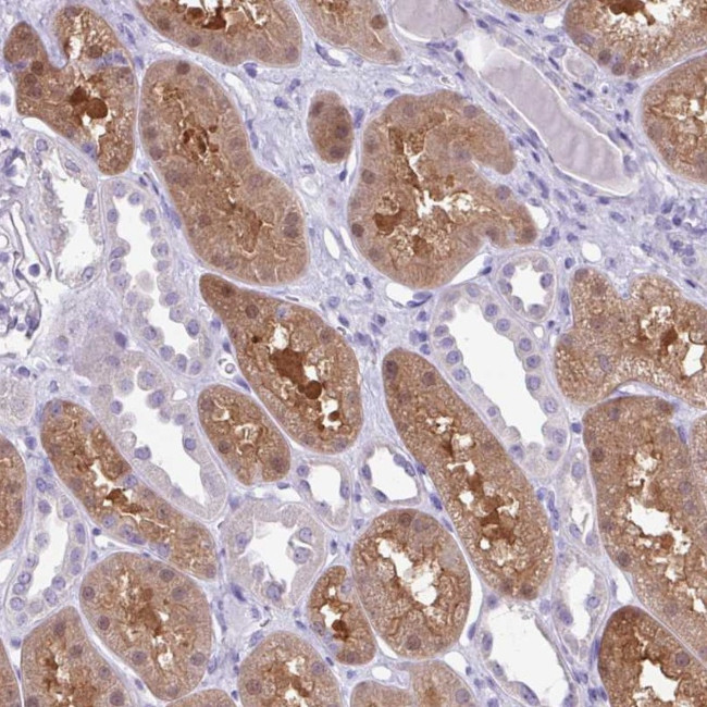 MDS2 Antibody in Immunohistochemistry (Paraffin) (IHC (P))