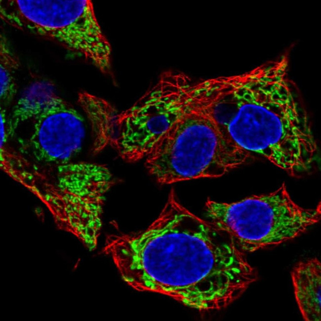 FDXR Antibody in Immunocytochemistry (ICC/IF)