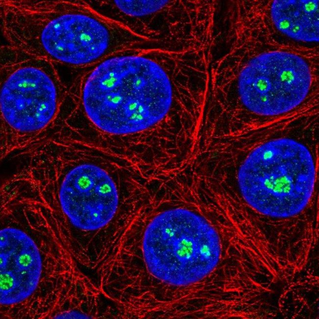 YBX2 Antibody in Immunocytochemistry (ICC/IF)