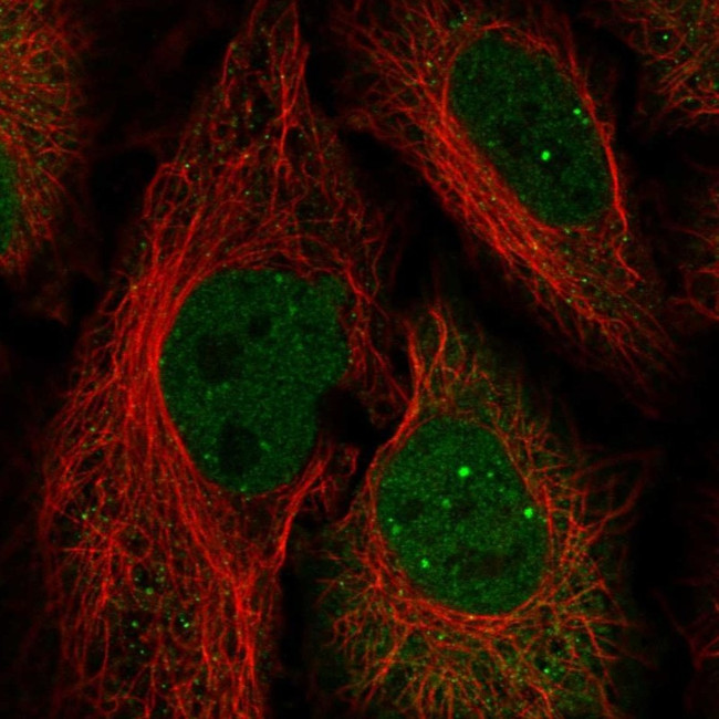 HOXC10 Antibody in Immunocytochemistry (ICC/IF)