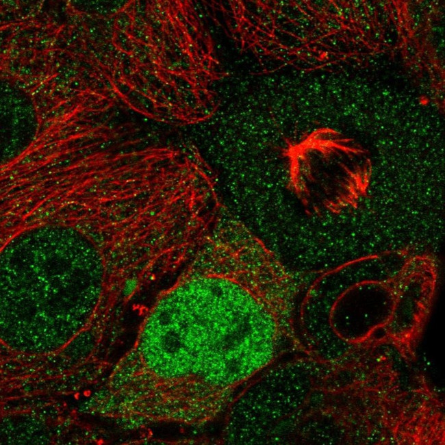 Cyclin D2 Antibody in Immunocytochemistry (ICC/IF)