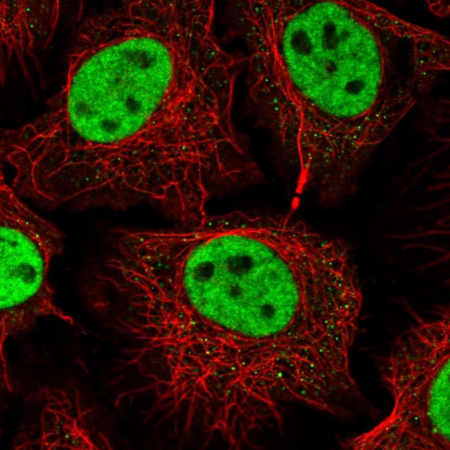 RNF40 Antibody in Immunocytochemistry (ICC/IF)