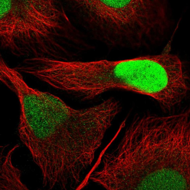 DUT Antibody in Immunocytochemistry (ICC/IF)