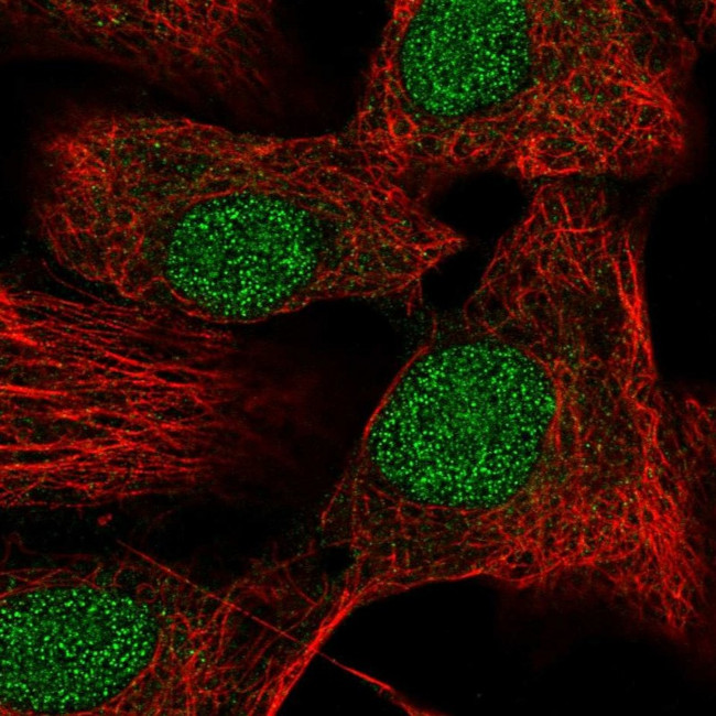 DR4 Antibody in Immunocytochemistry (ICC/IF)