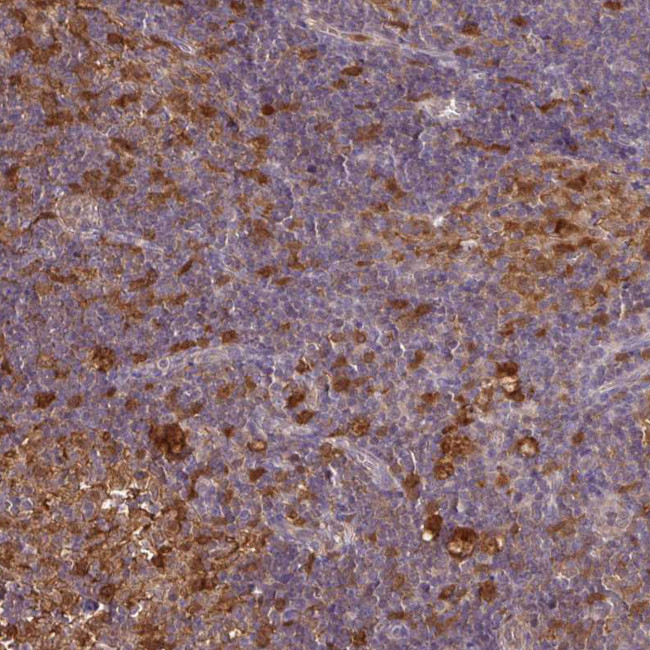 PYCARD Antibody in Immunohistochemistry (Paraffin) (IHC (P))